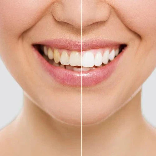 Dazzling White - Lapiz Blanqueador Dental